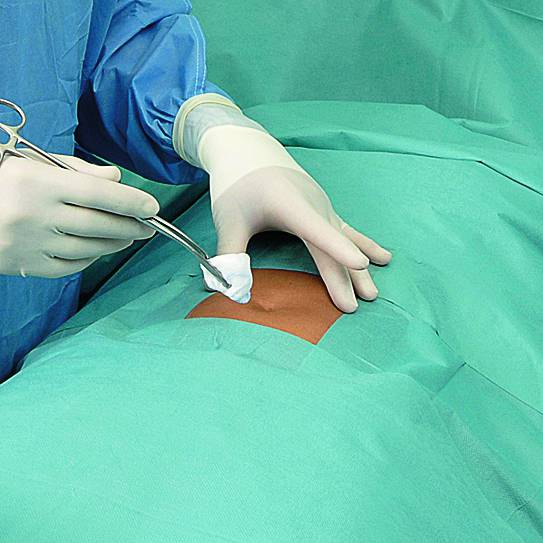Hartmann OP-Abdeckungs-Sets Foliodrape® Protect Basis-Set ambu - 10 Stück