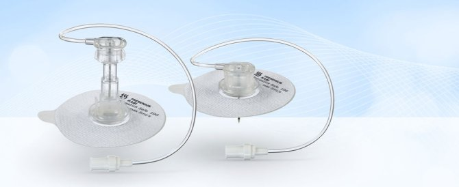 Fresenius Ambix Intrastick Safe Portkanüle - 20 G | 20 mm - 5 Stück