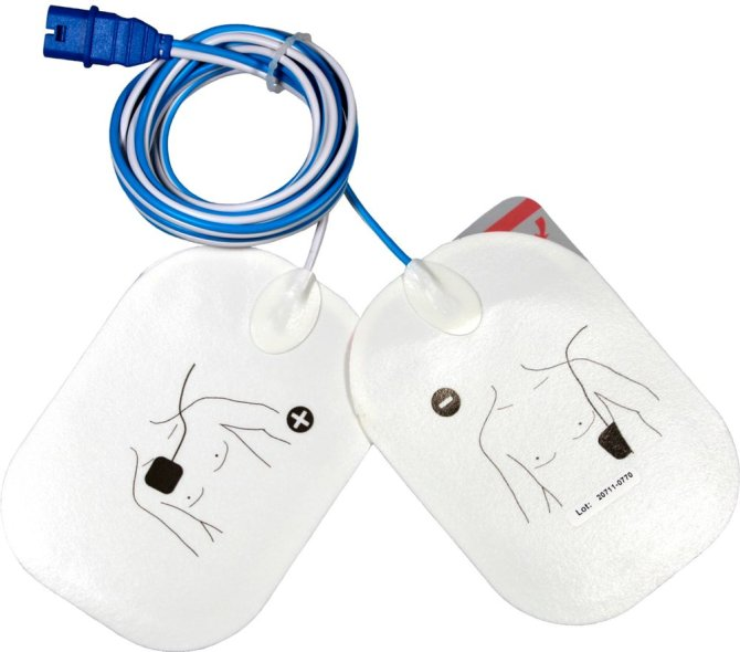 Defibrillations-Elektroden Erwachsene für SCHILLER-Geräte ( PA-1, easyport,easyport plus, APLC, APLC2, DGT7, DG HD-7, AT-101 easy )  - 1 Paar