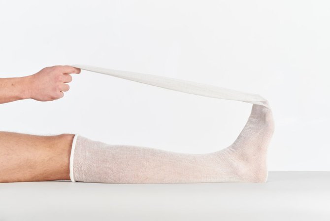COM-TeX® Tube, Gr. 1, 1,5cmx20m, Fingerverbände, 1 Stück