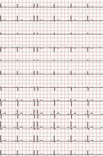 Registrierpapier für EKG Cardio-M-Plus - Medical Econet EKG - 25 Rollen